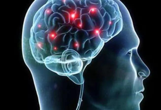 Plan maladies neurodégénératives